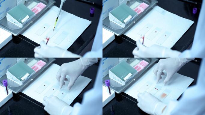 男性科学家在实验室做血液涂片试验