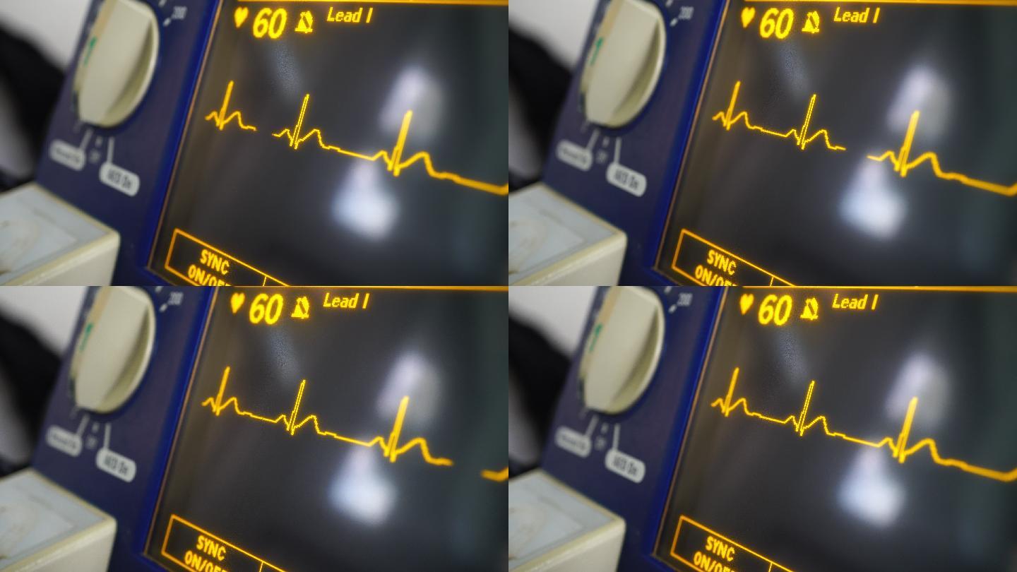 ECG监护仪医疗设备电子心跳图