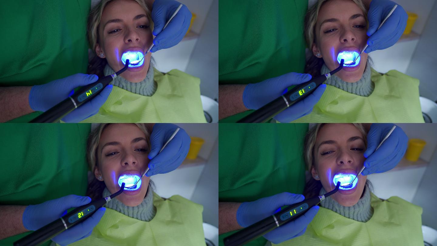 牙科医生使用紫外线灯硬化牙齿填充物