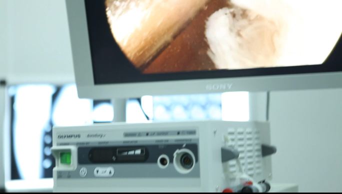 骨科腔镜针刀可视技术医疗设备医疗技术展示