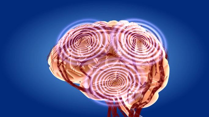 大脑治疗血液磁化