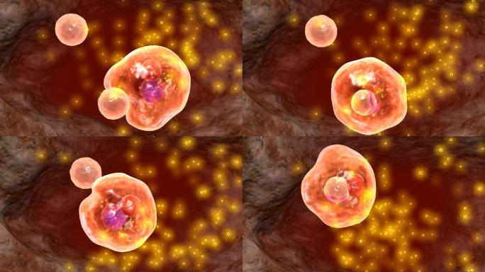 免疫细胞和关节细胞形成误识错误攻击