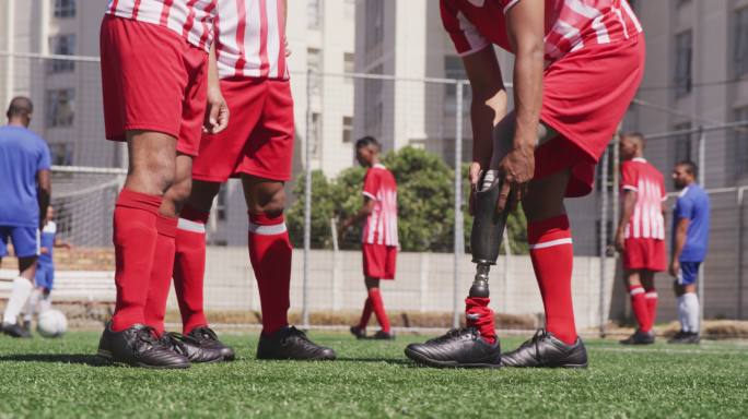 足球运动员摘除了假腿