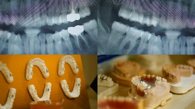 4K牙齿模型全牙牙片空镜