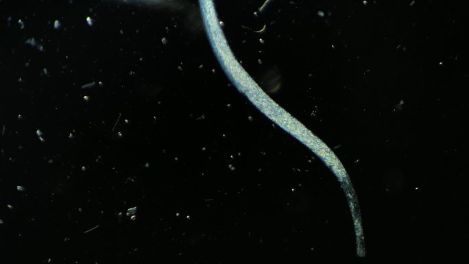 显微镜下的真实微生物 旋口虫