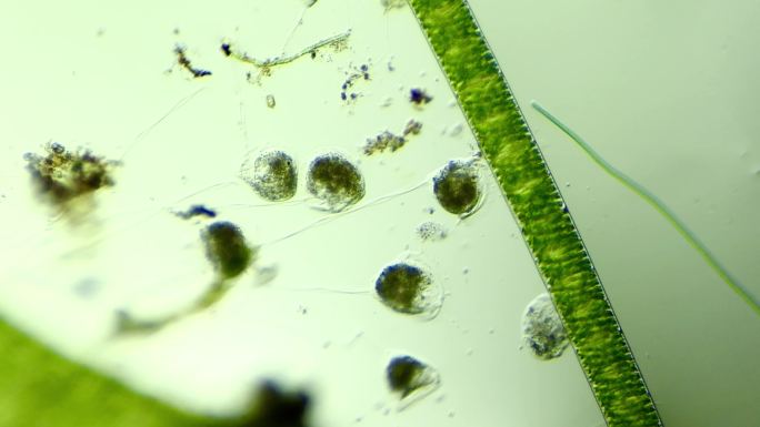 显微镜下的真实微生物 钟虫
