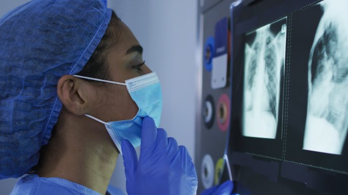 医护人员工作场景肺部拍片医疗研究X光片