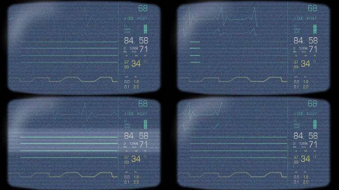 心脏监视器屏幕动画特效