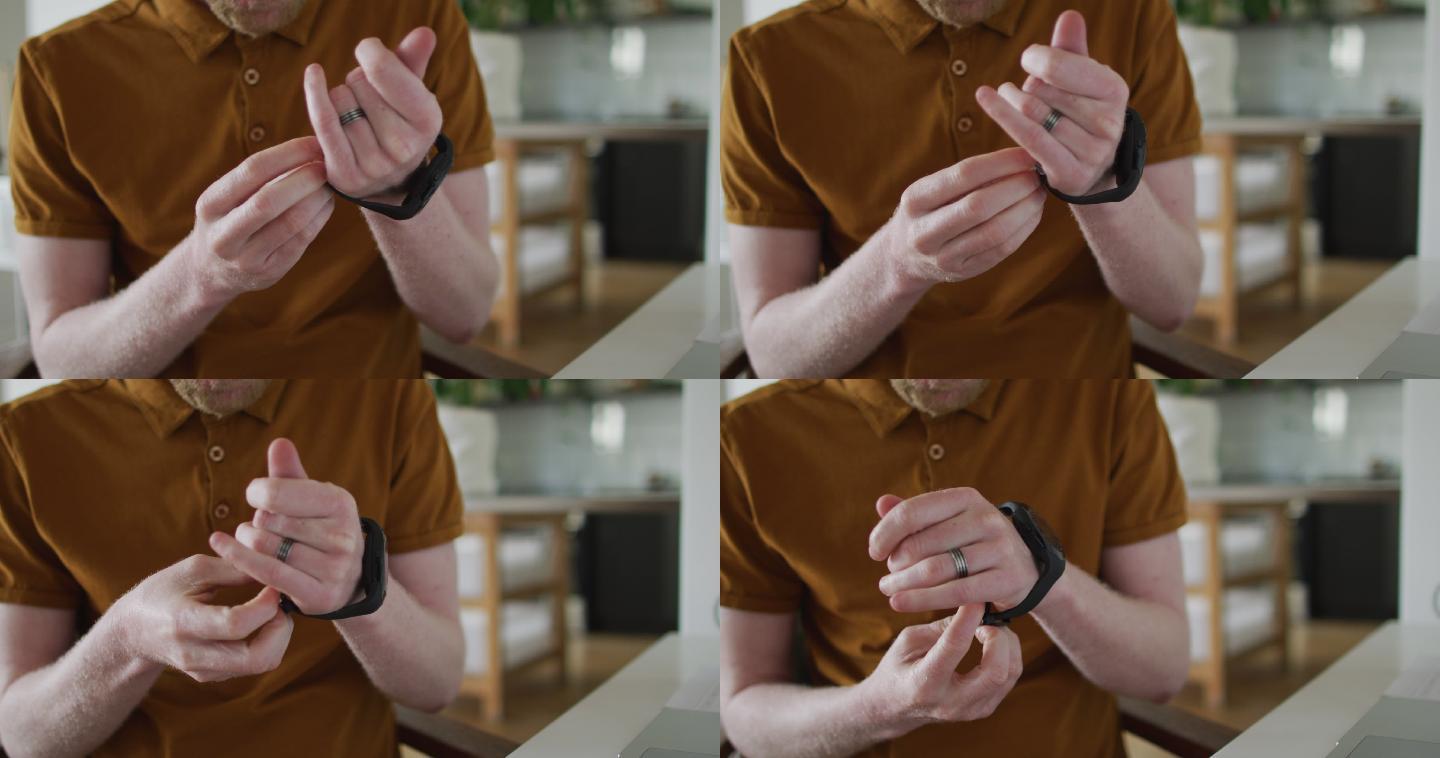 白化病非裔美国男子用智能手表梳脏辫