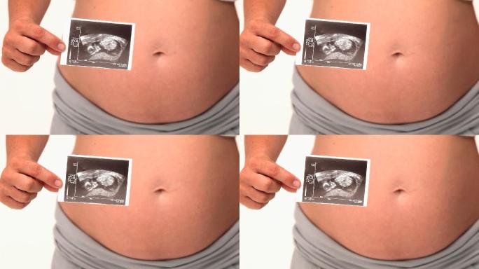 一名孕妇在白色背景下拿着她未来孩子的扫描图