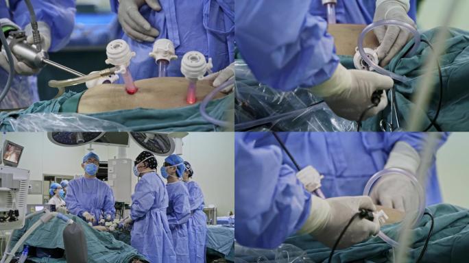 【原创】4K手术室做手术微创手术真实素材