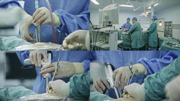 【原创】4K手术室医生做手术特写真实素材