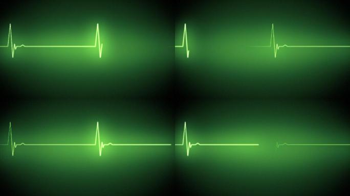 黑色背景上的绿色心脏监护线