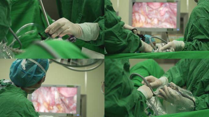 医生 手术 医疗设备 仪器  微创手术