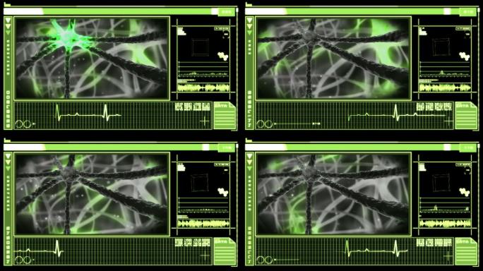 医学数字界面显示绿色神经元在黑色背景下通过神经系统