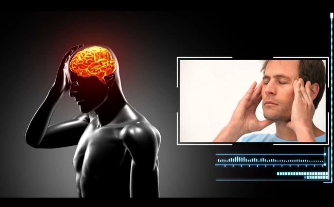 旋转图像与高亮的大脑显示头痛与相应剪辑的人有头痛