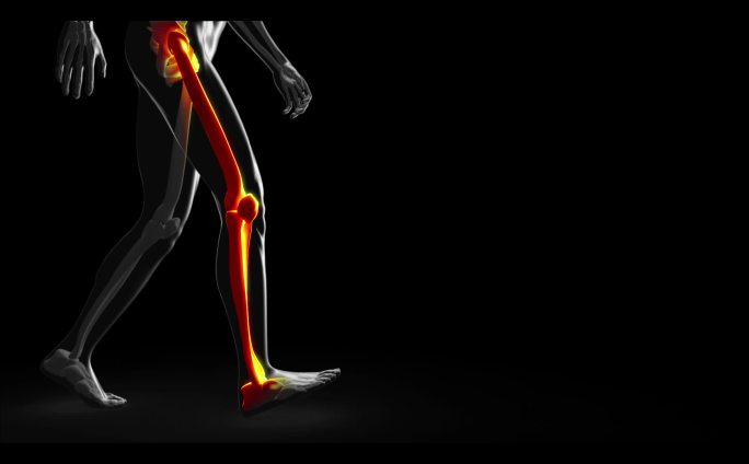 计算机模拟骨骼行走与脊柱、手臂和腿骨突出