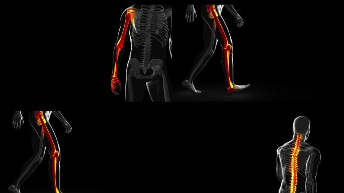 计算机模拟骨骼行走与脊柱、手臂和腿骨突出