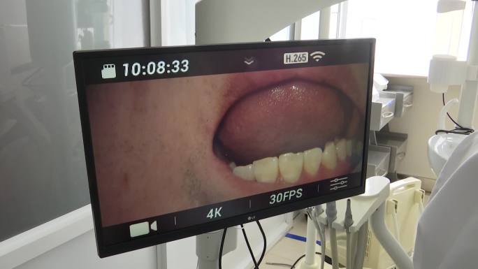 医院口腔科医生给病人治牙高科技仪器辅助