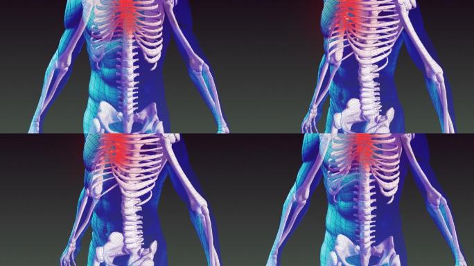 人类骨骼动画特效人体骨骼医学检查人类医学