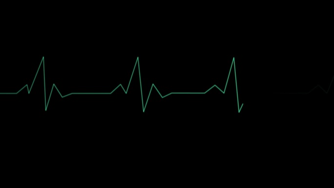 心脏监控器动画检查检测医学检查心脏波形