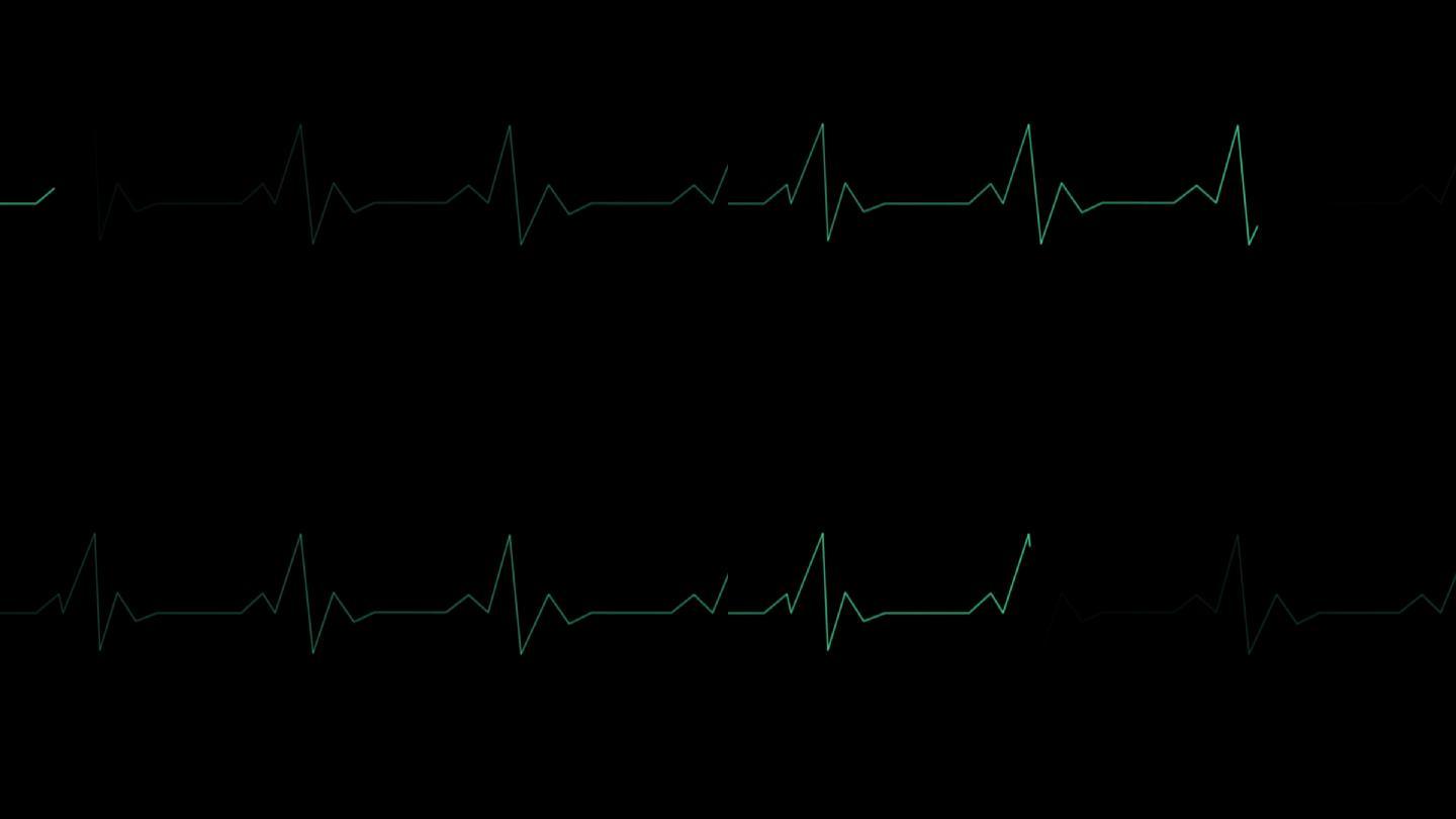 心脏监控器动画检查检测医学检查心脏波形