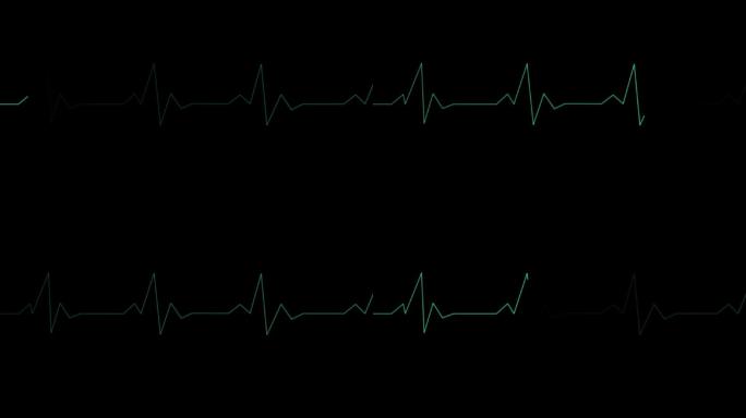 心脏监控器动画检查检测医学检查心脏波形
