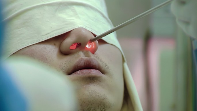 09鼻炎内窥镜检查患者蒙眼