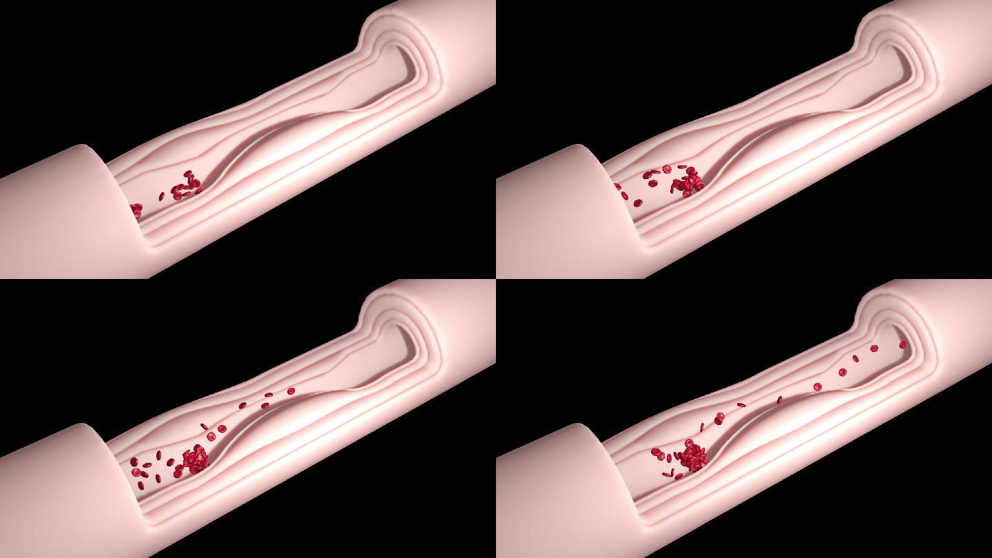 透视人体血管收缩动画