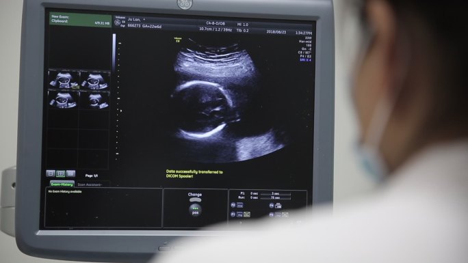 实拍孕妇超声波医院新生儿医疗器械