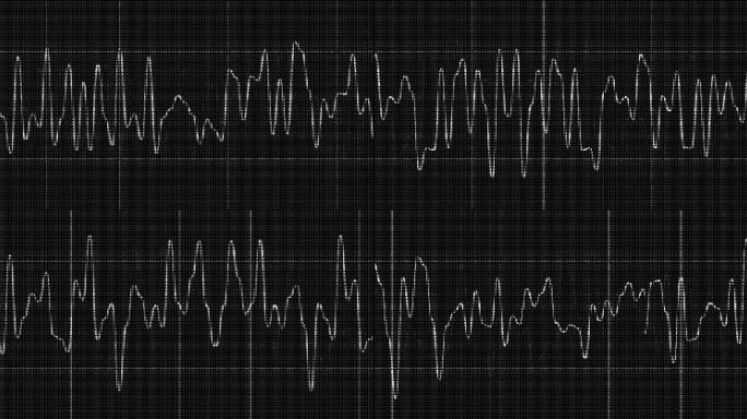 地震波浪线 心脏跳动线