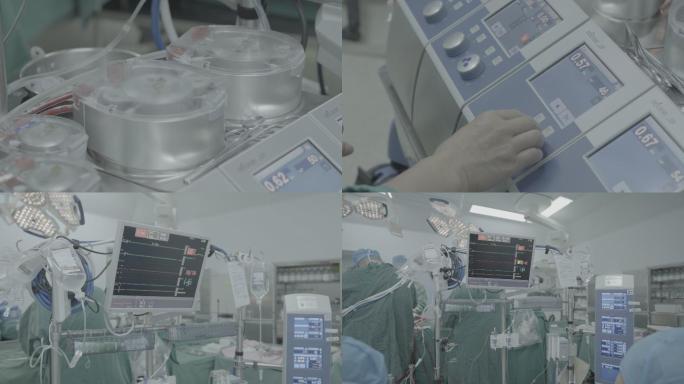心脏手术体外循环机准备+未调色