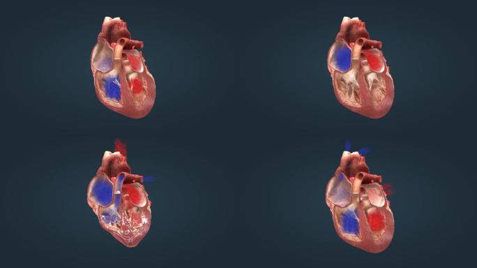 医学心脏解剖泵血功能心动周期三维动画
