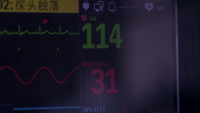 医院标准心电监护仪素材实拍