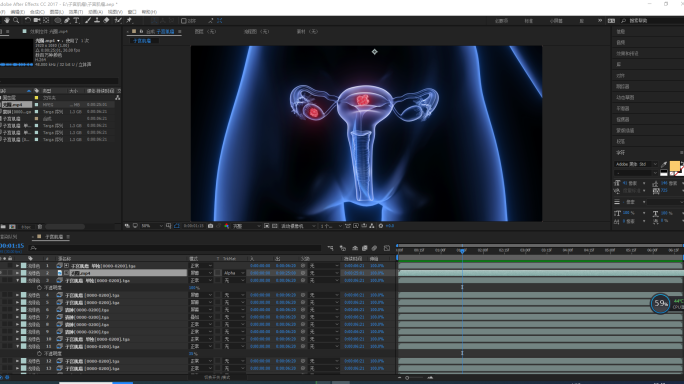 AE 工程宫颈癌 子宫肌瘤 卵巢囊肿