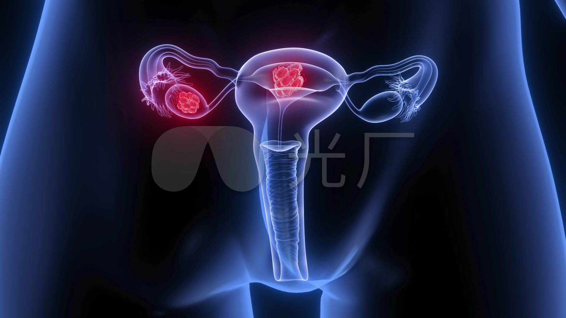 二、卵巢位置、大小、形态及回声-临床医学-医学