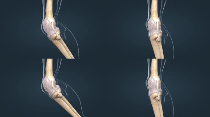关节囊韧带骨连接关节炎积液病变医学动画