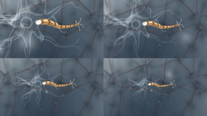 医学神经胞体树突树突尼氏体细胞膜神经元