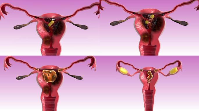 人体女性滋养子宫卵巢