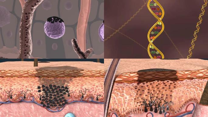 医学皮肤细胞黑色素瘤皮肤修复三维动画