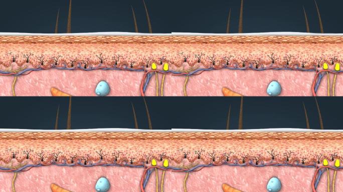 皮肤紫外线角化细胞黑素细胞黑色素医学动画