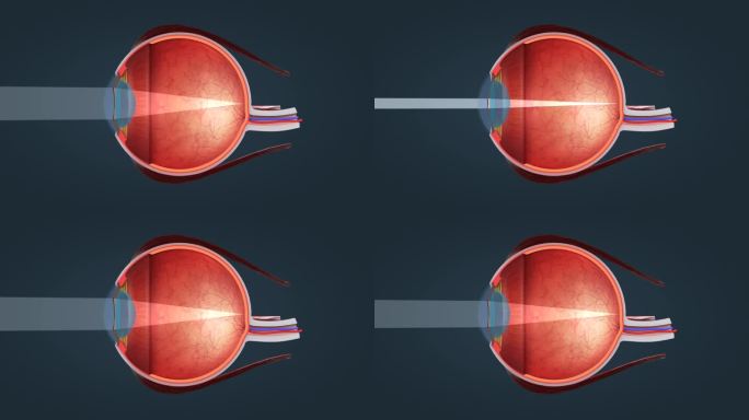 医学 眼睛 眼球 眼睛 光效 色盲 动画