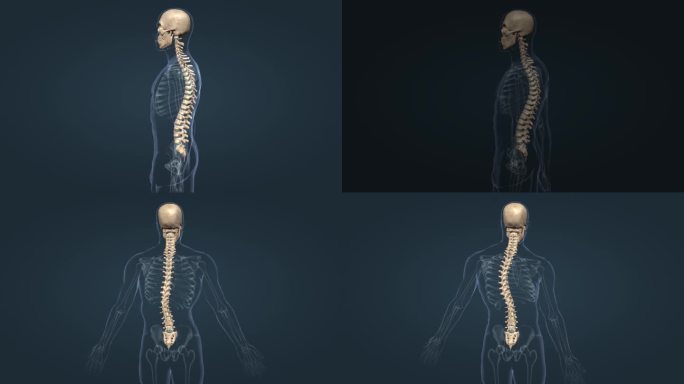 医学人体骨骼脊椎脊柱前凸后突侧弯疾病动画