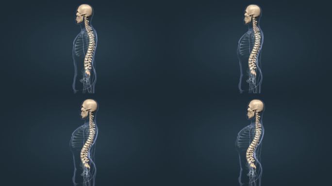 人体骨骼骨科脊椎前凸脊柱的疾病三维动画