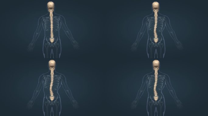 医学人体骨骼骨架脊柱侧弯脊柱疾病三维动画