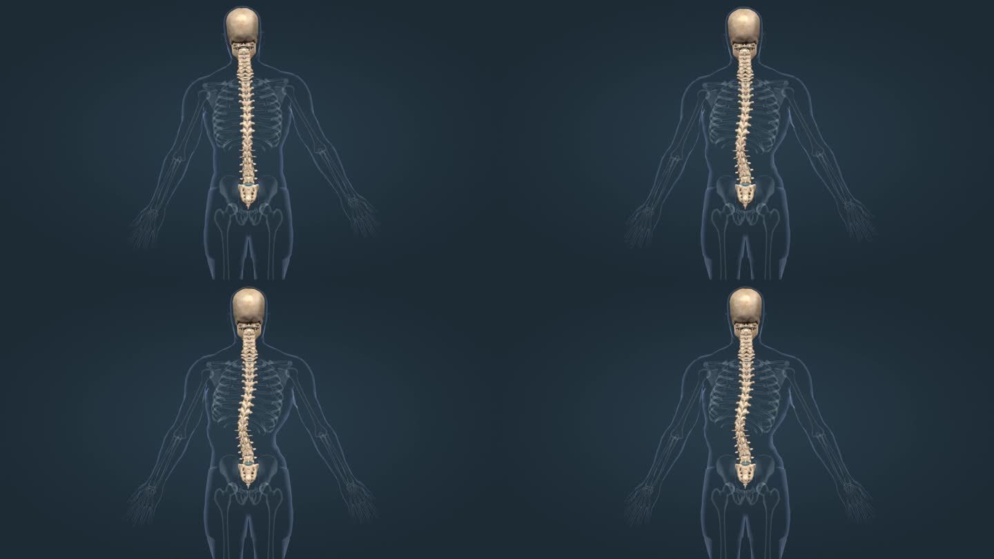 医学人体骨骼骨架脊柱侧弯脊柱疾病三维动画