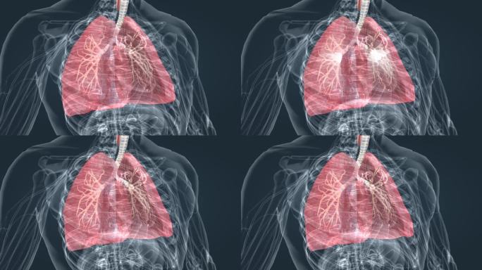 医学动画 肺功能 肺呼吸 肺活量 深呼吸
