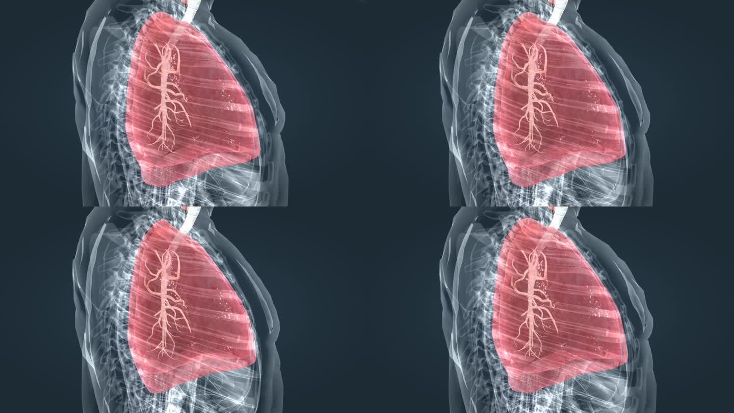 上呼吸道肺呼吸支气管炎疾病医学三维动画
