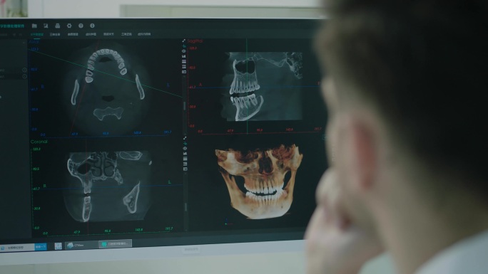 老外牙科医生思考分析CT