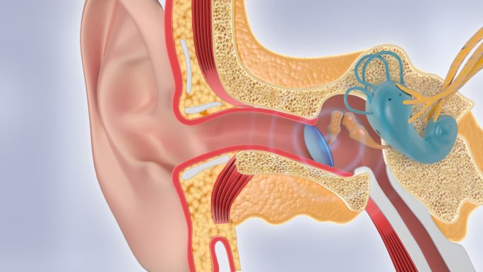 AE耳膜 耳鼓 耳病 听力  耳聋 耳鸣